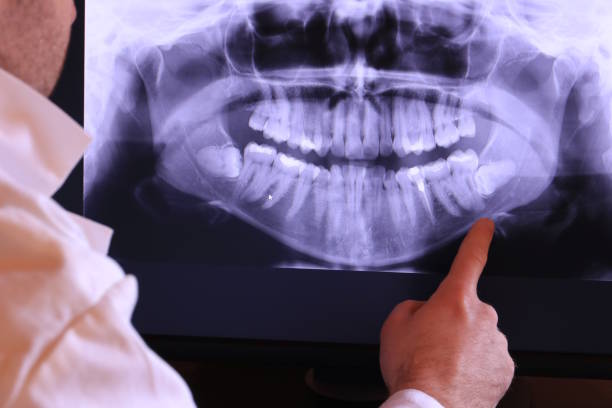Best Emergency Root Canal Treatment in Caldwell, TX