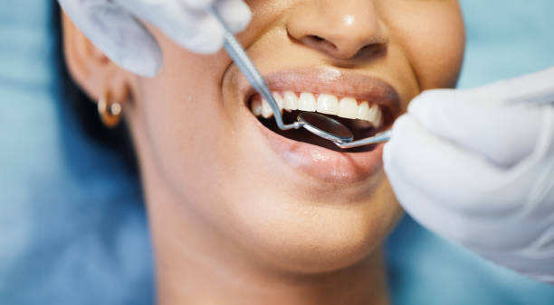 Best Emergency Root Canal Treatment in Caldwell, TX