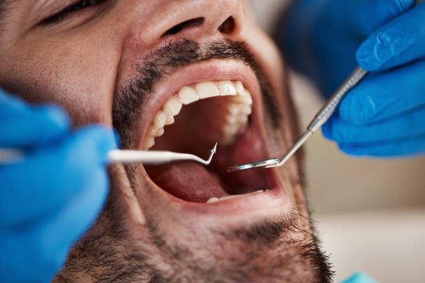 Best Emergency Dental Services for Seniors in Caldwell, TX